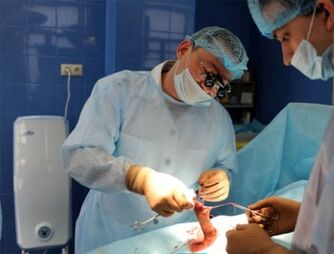 Cirugía de agrandamiento del pene realizada por cirujano